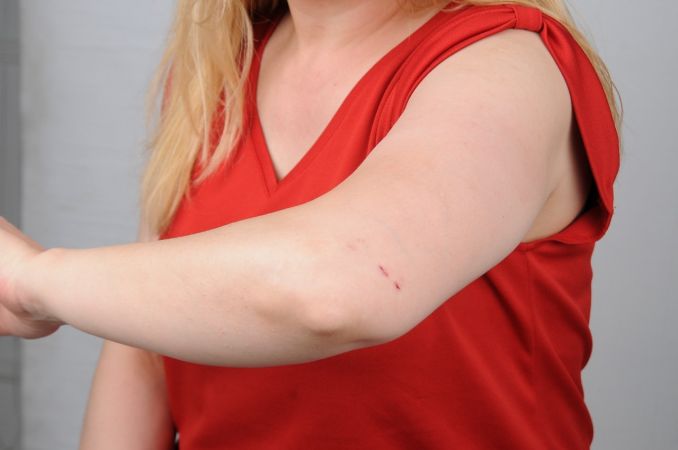 Son Dakika: Foto Haber...Gaziantep Cumhuriyet Başsavcılığından hemşirenin darp edilmesi olayıyla ilgili açıklama! 2