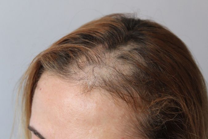 Son Dakika: Foto Haber...Gaziantep Cumhuriyet Başsavcılığından hemşirenin darp edilmesi olayıyla ilgili açıklama! 3