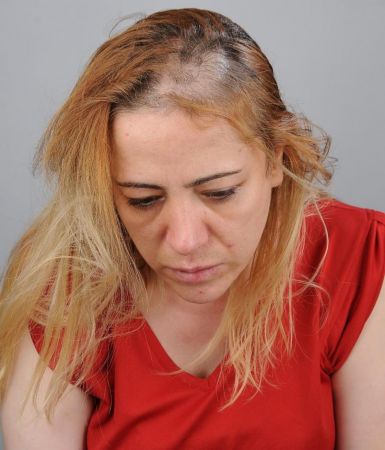 Son Dakika: Foto Haber...Gaziantep Cumhuriyet Başsavcılığından hemşirenin darp edilmesi olayıyla ilgili açıklama! 4