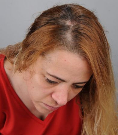 Son Dakika: Foto Haber...Gaziantep Cumhuriyet Başsavcılığından hemşirenin darp edilmesi olayıyla ilgili açıklama! 5