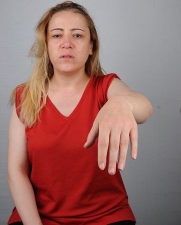 Son Dakika: Foto Haber...Gaziantep Cumhuriyet Başsavcılığından hemşirenin darp edilmesi olayıyla ilgili açıklama! 6