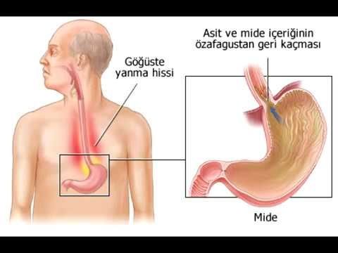 Foto Haber: Sakın ha sakın denemeyin: Kola içen genç yaşamını yitirdi! 6