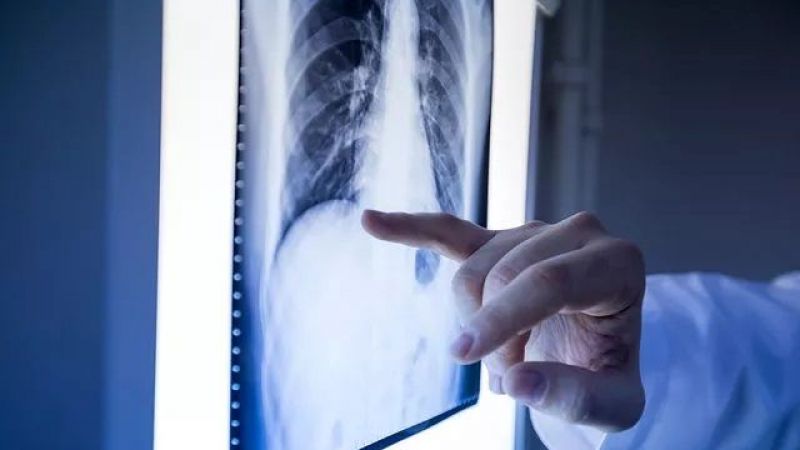 Parmaklarınızı Birleştirin, Kanser Olup Olmadığınızı Öğrenin! Kimsenin Bilmediği Bu Yöntem Kanser Riskini Gösteriyor, Üstelik 2 Saniyede! 1