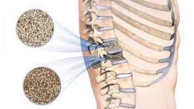 Kemik Erimesine Karşı Doğal Besinle Çözüm Bulundu! Bilim İnsanları Tavsiye Etti: Her Gün Tüketin! 4