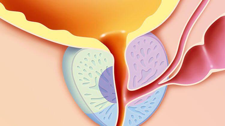 En Sık Ölüme Neden Olan Hastalıklar Arasında Bulunuyor ve Çok Fazla Yanlış Bilgi İçeriyor! Uzman İsim Açıkladı: Bunlara Gerek Yok… 1