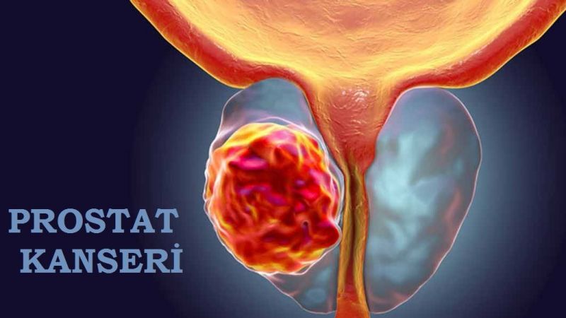 En Sık Ölüme Neden Olan Hastalıklar Arasında Bulunuyor ve Çok Fazla Yanlış Bilgi İçeriyor! Uzman İsim Açıkladı: Bunlara Gerek Yok… 2