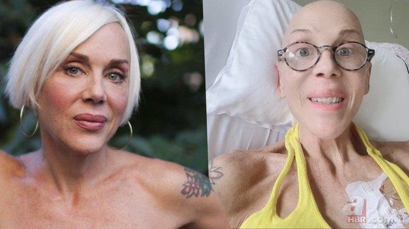 Akciğer kanseri olan Billur Kalkavan’dan acı haber geldi! “Bir adam karısını kaybediyor…” Sevgilisi Buğra Bahadırlı ilk kez konuştu! 4