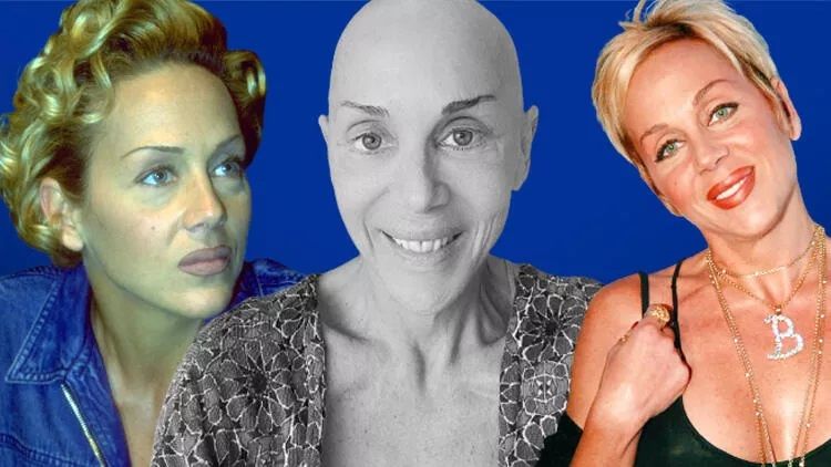 Akciğer kanseri olan Billur Kalkavan’dan acı haber geldi! “Bir adam karısını kaybediyor…” Sevgilisi Buğra Bahadırlı ilk kez konuştu! 1