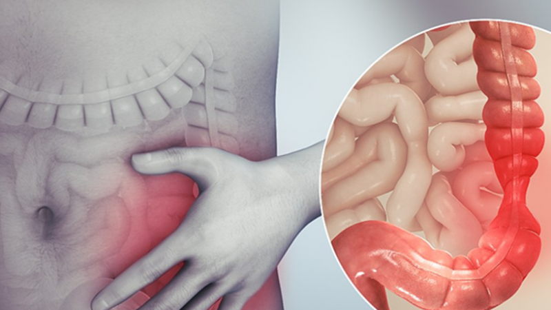 Bu Hastalıklar Gençleri Hedef Alıyor! Uzman İsim Açıkladı: İshal ve Karın Ağrısı Şikayetlerinizi Hafife Almayın! 1