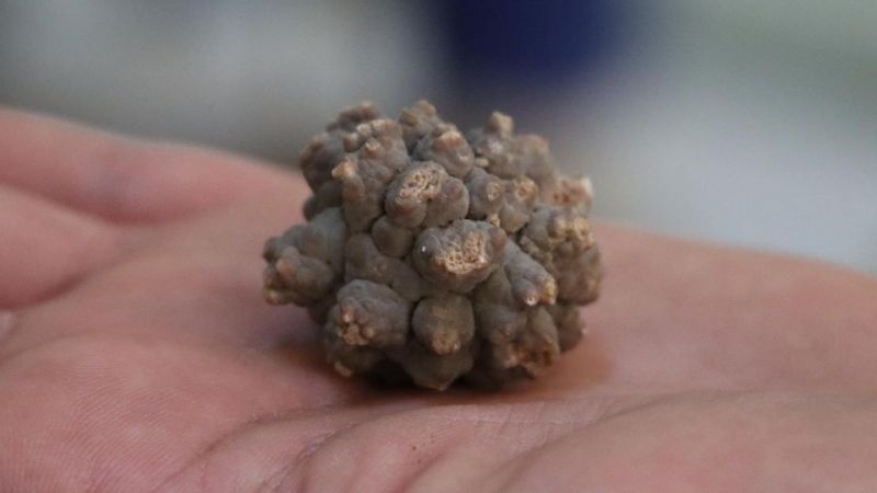 Vücuda Verdiği Zararlar Bitmek Bilmiyor! Böbrek Taşına Sebep Olan O Yiyecekler! 2