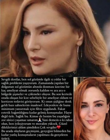 Estetik yaptırdı demişlerdi; söylenenlere dayanamadı! Yalı Çapkını’nın Defnes’si Mine Tugay, önce açıkladı; sonra pozlarını paylaştı! Meğer… 3