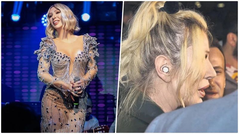 Seda Sayan'ın sırrı ifşa oldu! Meslek hastalığına yakalandı! Ömür boyu… 1