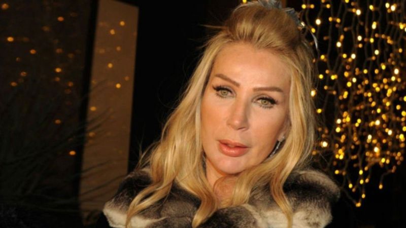 Seda Sayan'ın sırrı ifşa oldu! Meslek hastalığına yakalandı! Ömür boyu… 2