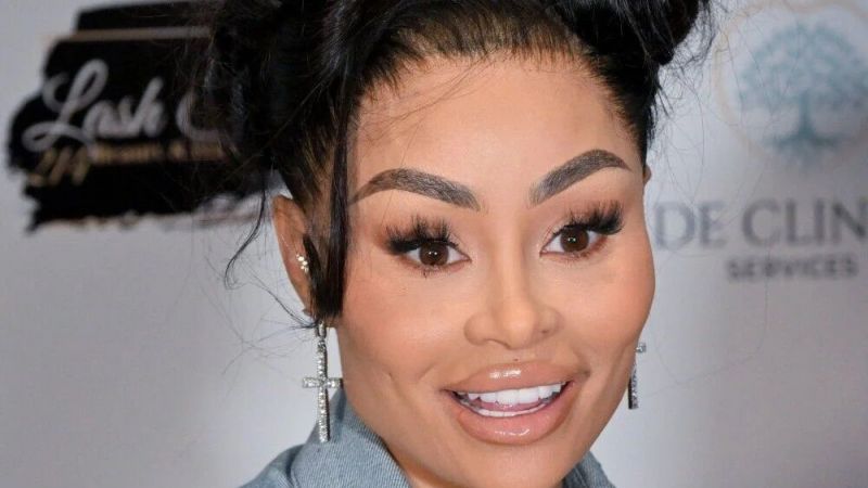 Kardashianların gelininden 19 yaş itirafı! Daha dolgun kalçalara sahip olmak için… 2