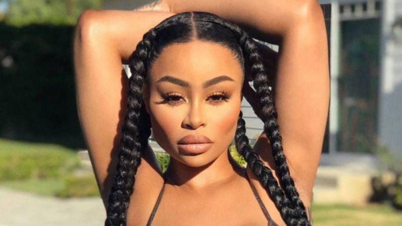 Kardashianların gelininden 19 yaş itirafı! Daha dolgun kalçalara sahip olmak için… 3