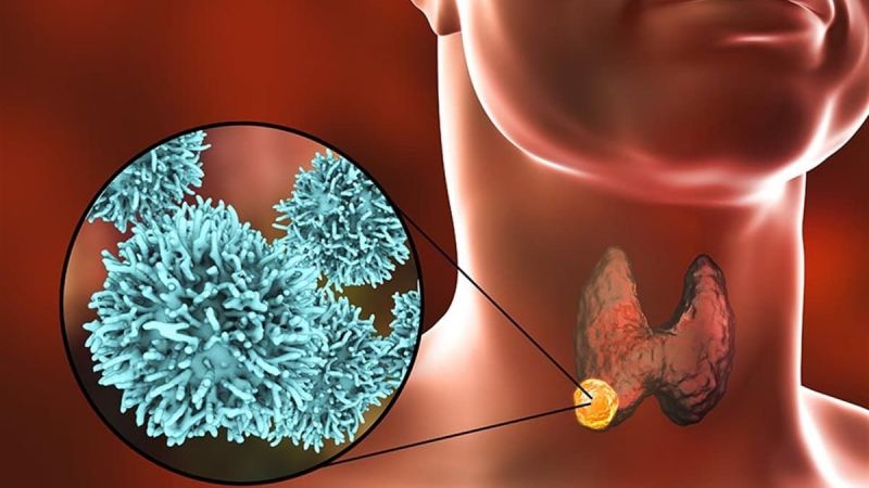 Kanser İçin 2040 Yılına Kadar Yüzde 55 Artış Bekleniyor! Kadınlar Ve Erkekler En Sık Görülen Türü İse Belli Oldu! 2