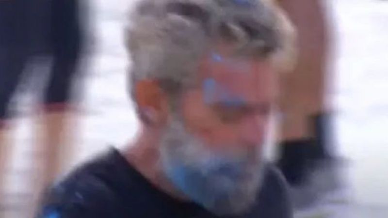 Survivor Ödül Oyununda Korkutan Anlar! Oyun Sırasında Başından Yara Alan Yarışmacı Murat Eken’e Doktor Müdahale Etti! 2