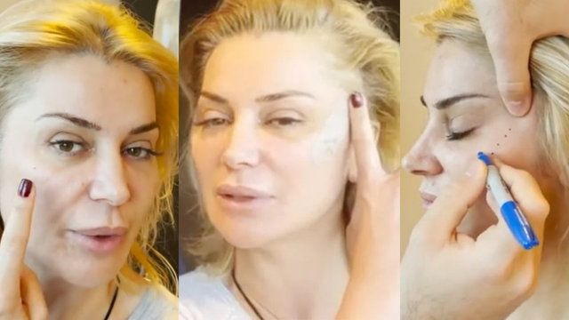 Songül Karlı’dan yine güzellik operasyonu! Ünlü isim tekrar estetik yaptırdı! 2
