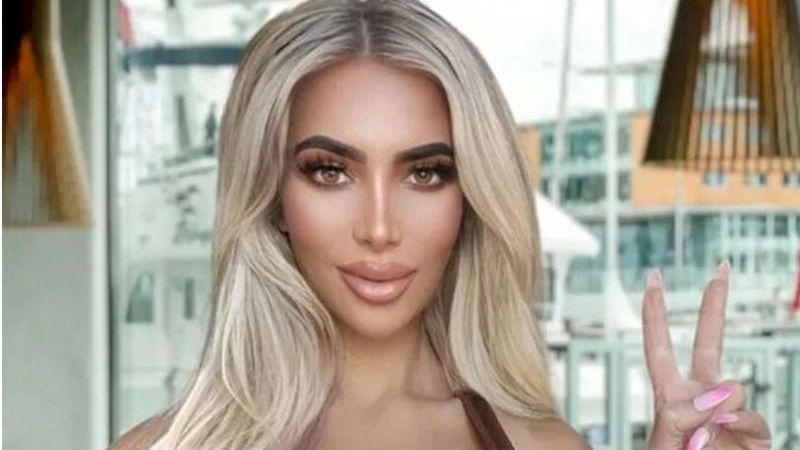 Kim Kardashian’a benzemek için bıçak altına yattı! Ünlü model bu uğurda hayatından oldu! 3