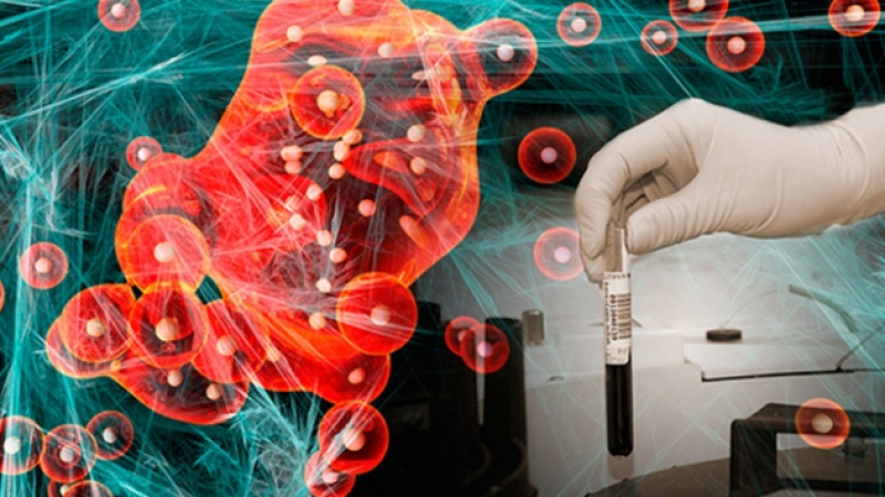 Yüksek Riskli Kanser Hastaları Erken Tespit Edilecek! Yapay Zekâ Modellemesi Nasıl Çalışıyor? 3