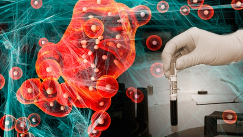 Kansere Erken Teşhis Konulabilecek! Bilim İnsanları Tarafınca Geliştirilen Yapay Zeka Modellemesi! 1