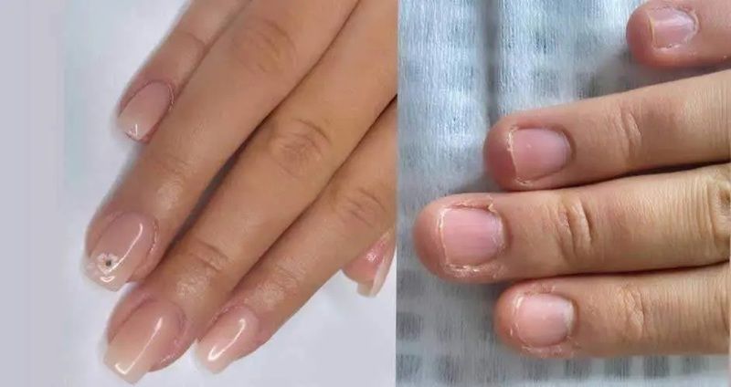 Sağlıklı Tırnaklara Kavuşun! Yaz Aylarında Tırnak Bakımı! 1