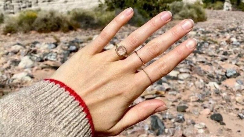 Lily Collins'in yüzüğü Hollywood'da otelin spasından çalındı! 3