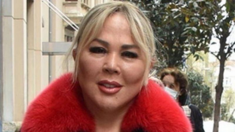 Safiye Soyman estetik ameliyatlarını paylaştı: O artık eskisi gibi değil! 1