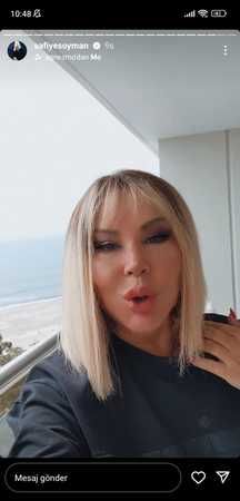 Safiye Soyman estetik ameliyatlarını paylaştı: O artık eskisi gibi değil! 2