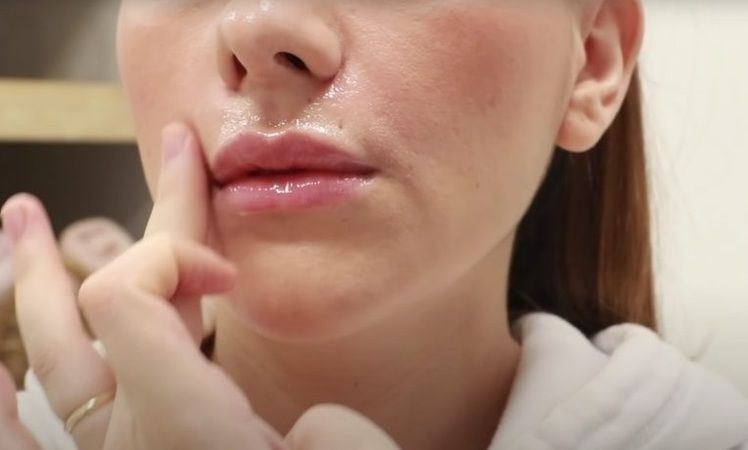 İstenmeyen tüylerden nohut sayesinde kurtulmanızı sağlayan teknik! Çok etkili çok 1