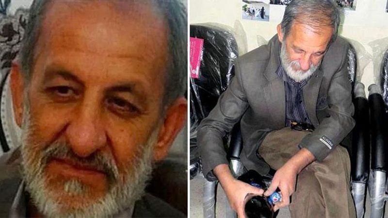 Kimse onun hastalığına çözüm bulamadı: 17 yıldır yemek yiyemiyor! 2