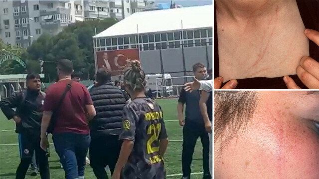 Amatör Lig’de istenmeyen olaylar! Konyaaltı Gençlik Spor futbolcularına saldırı! 2