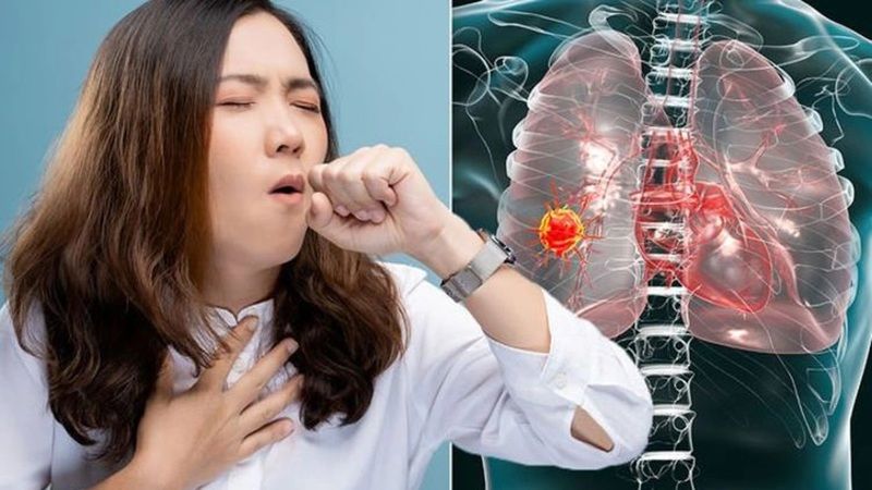 Dünyada en yaygın kanser türlerinden biri! Akciğer kanseri semptomları nelerdir? 3