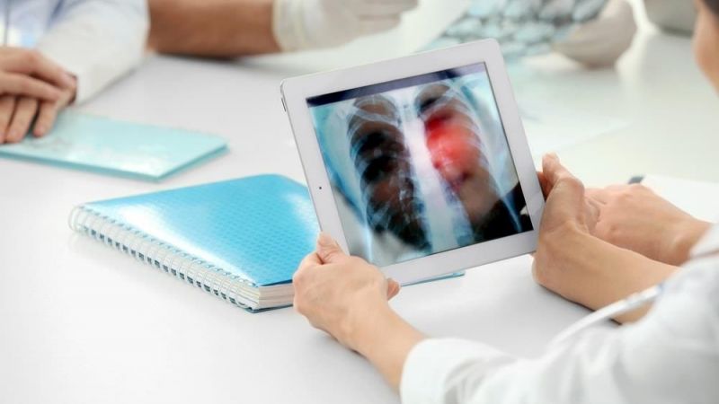 Dünyada en yaygın kanser türlerinden biri! Akciğer kanseri semptomları nelerdir? 5