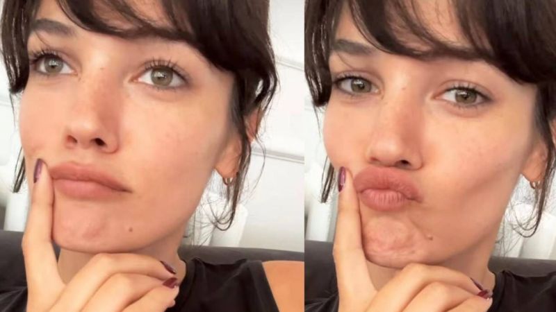 Pınar Deniz’in son hali estetik iddialarını gündeme getirdi! Ünlü isim yaptığı paylaşımında dudaklarının… 3