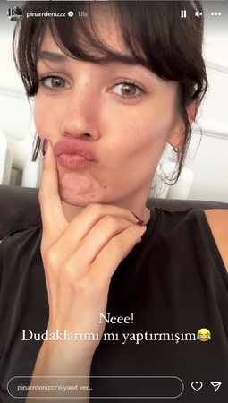 Pınar Deniz’in son hali estetik iddialarını gündeme getirdi! Ünlü isim yaptığı paylaşımında dudaklarının… 2