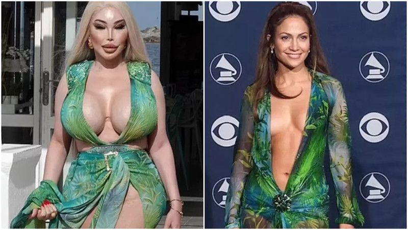 Jessica Alves’ten yeni karar! Barbie tutkunu isim şimdi Jennifer Lopez olmak için 100 ameliyat geçirdi! 1