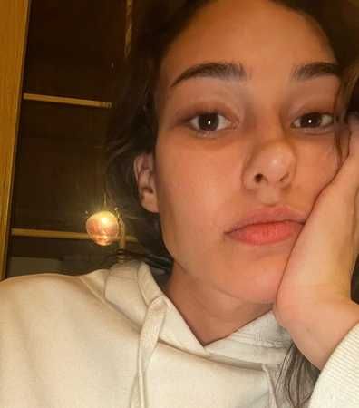 28 yaşındaki Dilan Çiçek Deniz, Seda Sayan’a özendi! Yüz estetiği ile eleştiri yağmuruna tutuldu! “Neden kendine bunu yaptın?” 2