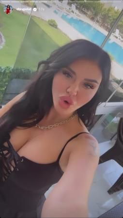 Ebru Polat'ın cazibesine sivrisinekler bile dayanamadı: “Her yerim ısırık!” 3