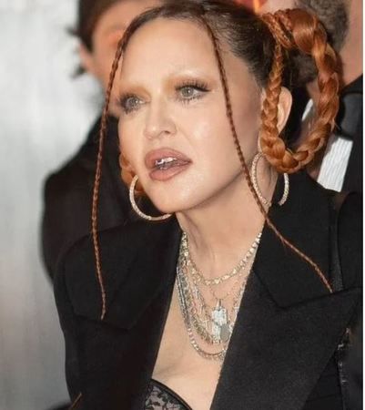 Madonna’nın akılalmaz tutkusu sonu olacaktı! Hastalık sebebi meğer… 2