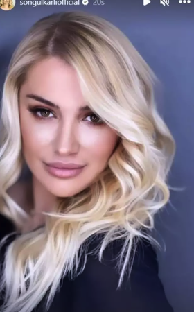 Songül Karlı'nın Estetik Müdahaleleriyle Değişen Görünümü: Hadise ve Petek Dinçöz'e Benzetiliyor! 1