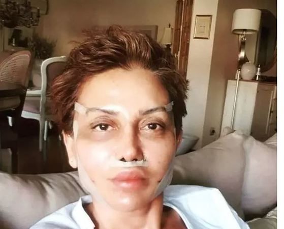 Estetikle yüzünü değiştirdi ancak geçmişinden kaçamadı! Gerçeğin Peşinde'nin sunucusu Serap Paköz’ün takipçisine verdiği şok yanıt! 2