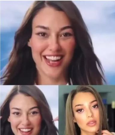Dilan Çiçek Deniz reklam teklifi için yüzünden oldu! Görenler tanıyamadı “Eski hali daha güzeldi” 3