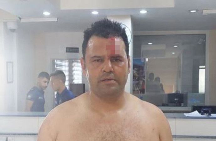 Survivor Hikmet’in skandal görüntüleri ortaya çıktı, yer yerinden oynadı! “Beni öldürmeye çalıştı…” 2