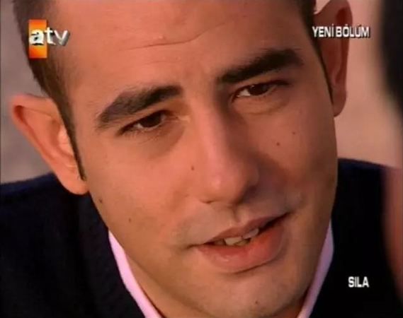 Ömer’in Erdal’ı estetikli çıktı! “Bu ne hal?” Eski halini görenler sadece gözlerden tanıyabildi! 2