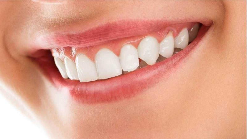Diş etlerinde hassasiyet varsa sebebi bu olabilir! Diş eti iltihabının belirtileri nelerdir? Diş eti iltihabının nedenleri… 1