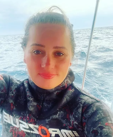 Survivor Özlem Çalın'ın İnanılmaz Değişimi! Görenler Şok Oldu 3