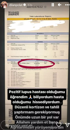 Dilan Polat'ın Acı İtirafı: "Pozitif Lupus Hastasıyım" 2