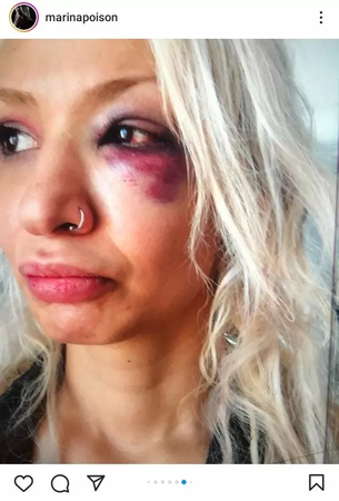 Yüzyüzeyken Konuşuruz Grubunun Gitaristi Şiddet İddiasıyla Gündemde! 4