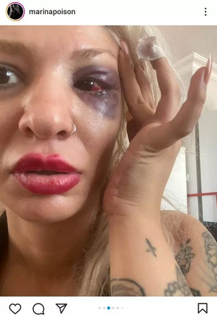 Yüzyüzeyken Konuşuruz Grubunun Gitaristi Şiddet İddiasıyla Gündemde! 2